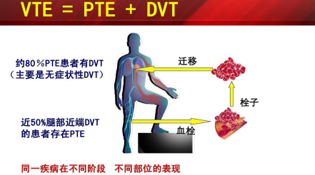 什么是臨床上一致公認(rèn)的VTE防治基礎(chǔ)？